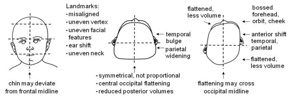 head shape info